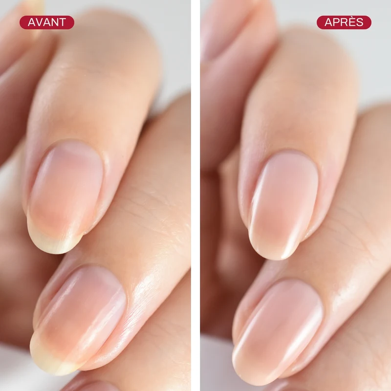 Base Bouclier de l’Ongle