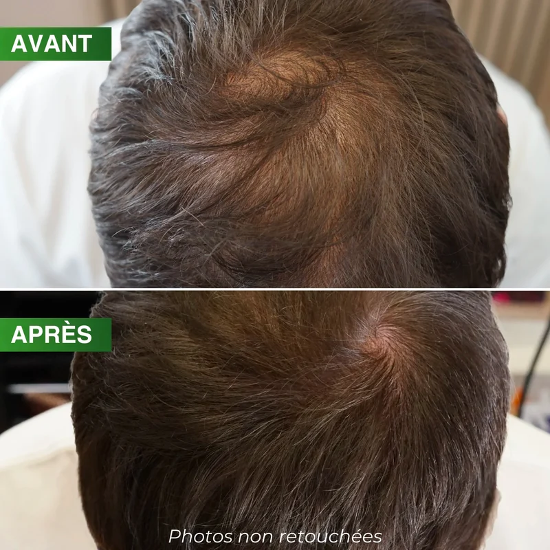 Ampoules Densité Pro BBHAIR Generik 10x10ML