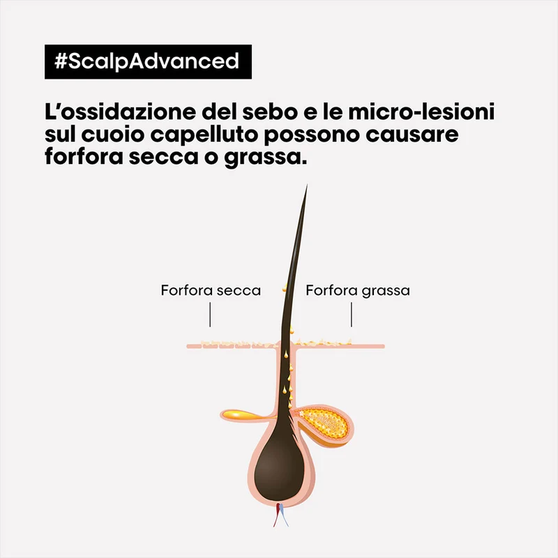 L'Oreal Professionnel Paris Scalp Advanced Anti-Dandruff Shampoo 300ml - shampooing antipelliculaire