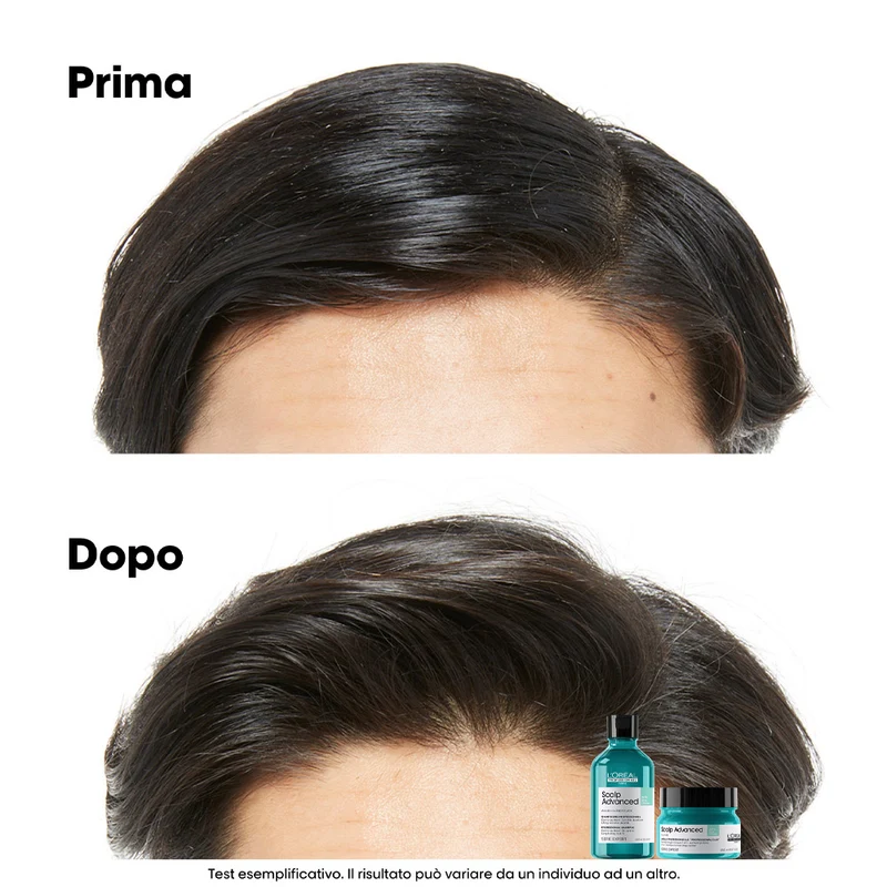 L'Oreal Professionnel Paris Scalp Advanced Anti-Oiliness Shampoo 300ml - shampooing séborégulateur