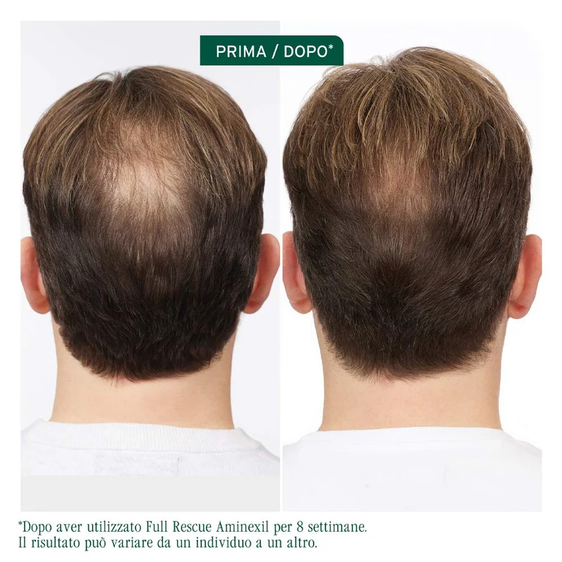 Biolage Professional Hair Spa Full Rescue Aminexil 6x10ml - ampoules anti-chute
