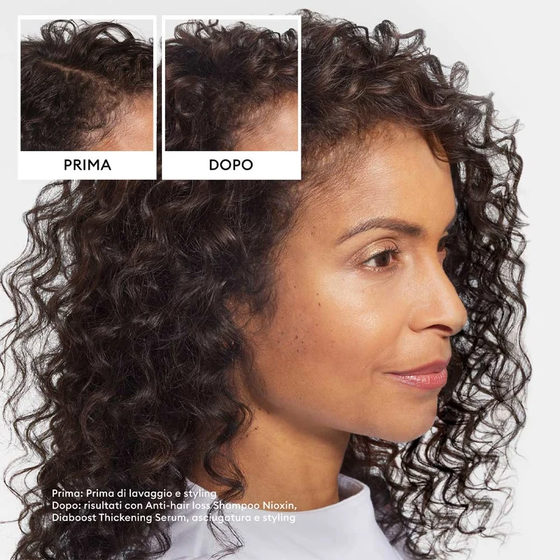 Nioxin Anti Hair Loss Shampoo 240ml - shampooing anti-chute