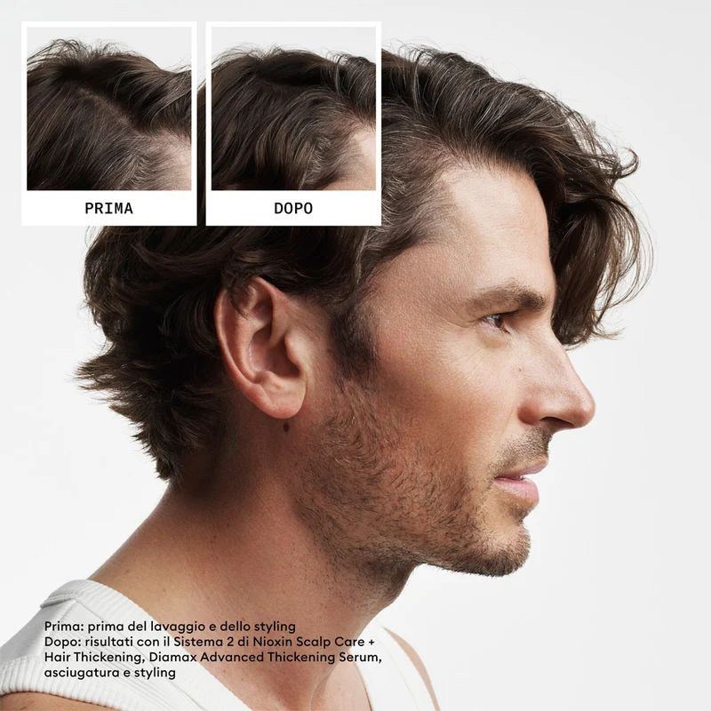 Nioxin Système 2 Kit Triphasique 150ml - kit anti-amincissement avancé