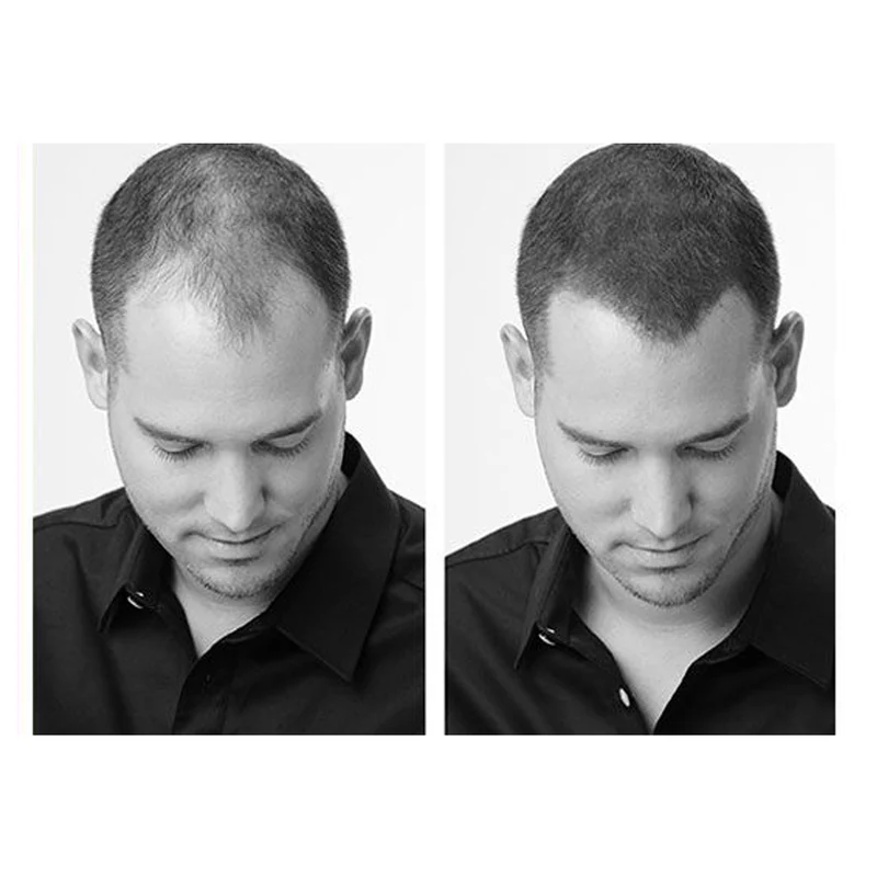 Hair 30 Blond Foncé