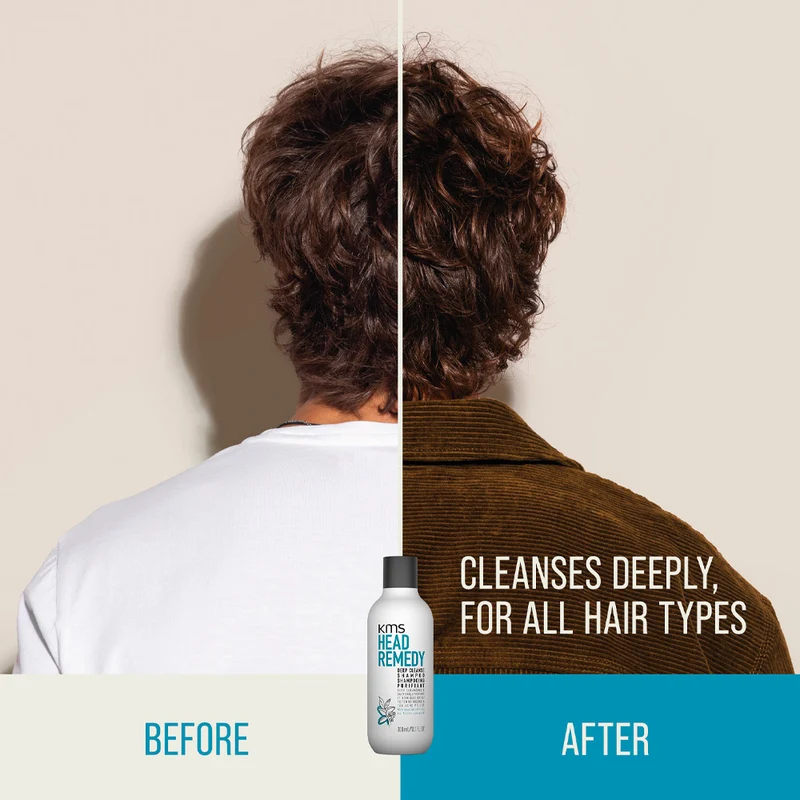 KMS Head Remedy Deep Cleanse Shampoo 300ml - shampooing nettoyage profond