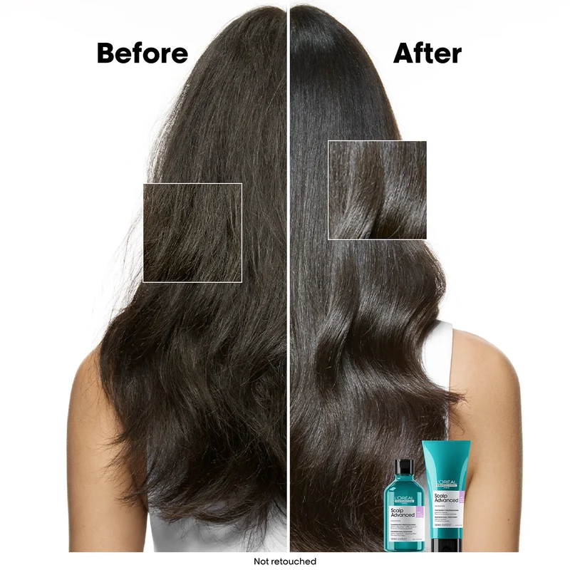 Scalp Advanced Anti-Discomfort Shampooing Refill - 500ml