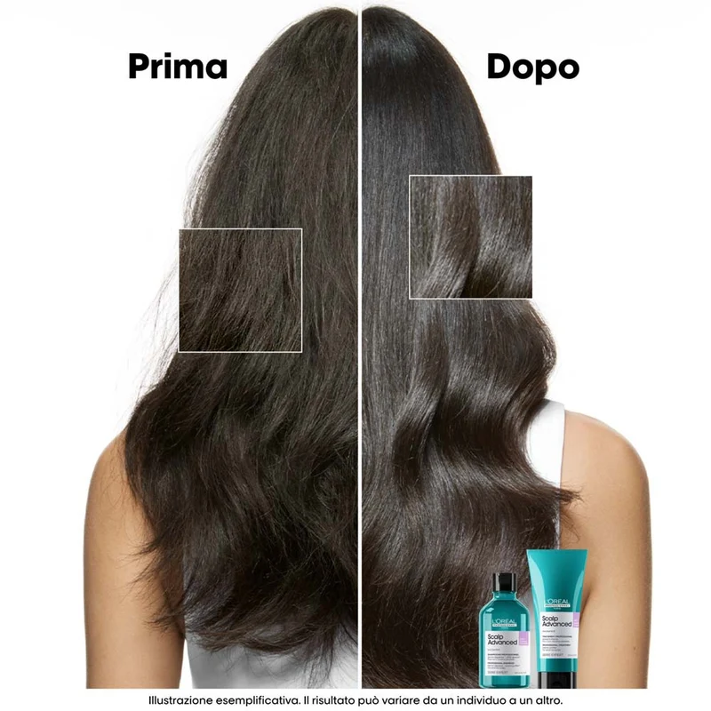 L'Oreal Professionnel Paris Scalp Advanced Anti-Discomfort Shampoo Refill 500ml - éco-recharge shampooing apaisant