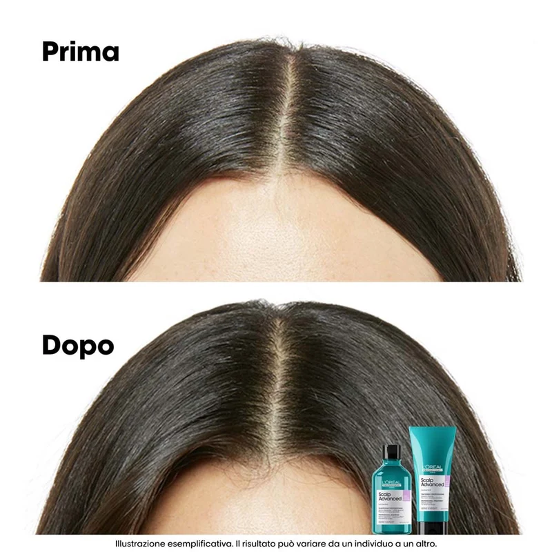 L'Oreal Professionnel Paris Scalp Advanced Anti-Discomfort Shampoo Refill 500ml - éco-recharge shampooing apaisant