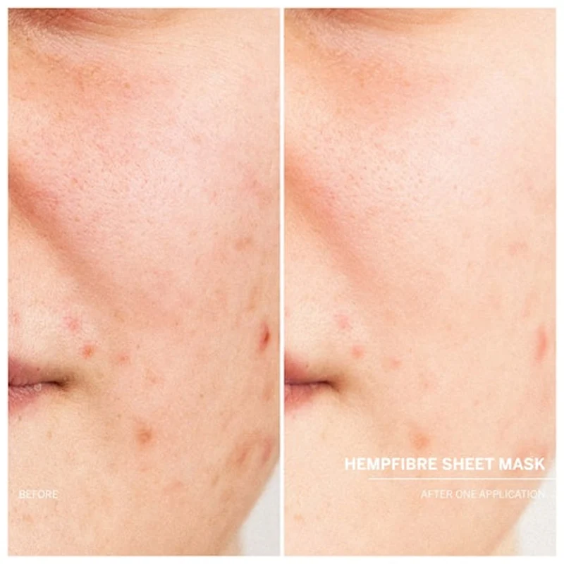 masque facial en tissu rafraîchissant