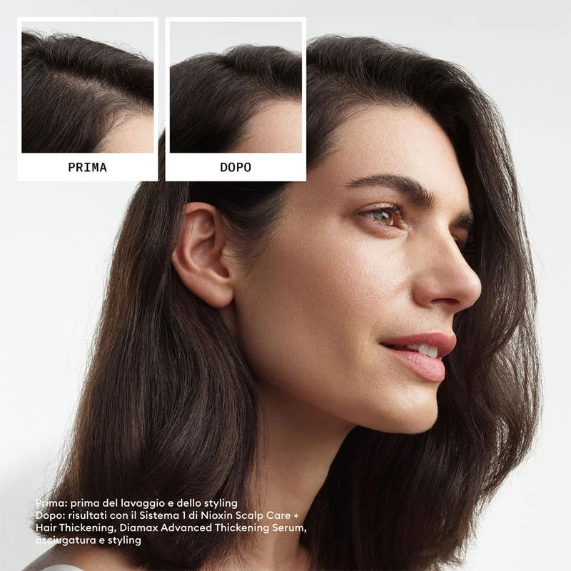 Nioxin Sistema 3 Kit Trifasico 150ml
